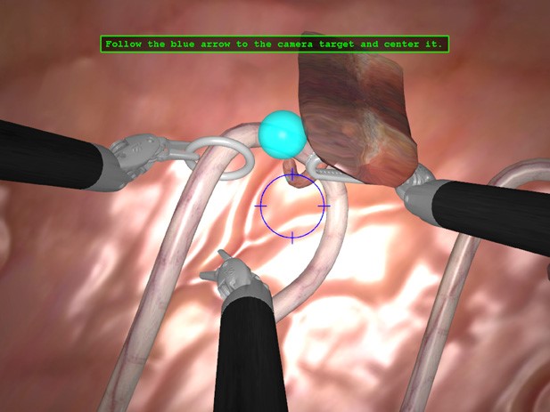 utilização de robôs em cirurgia - visão interna