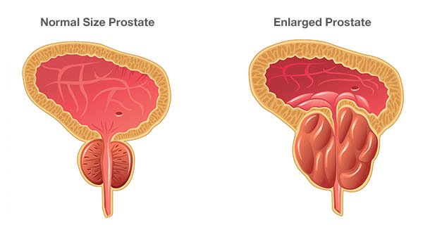 prostata este un organ