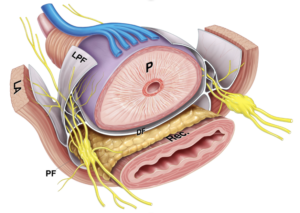 prostatectomia