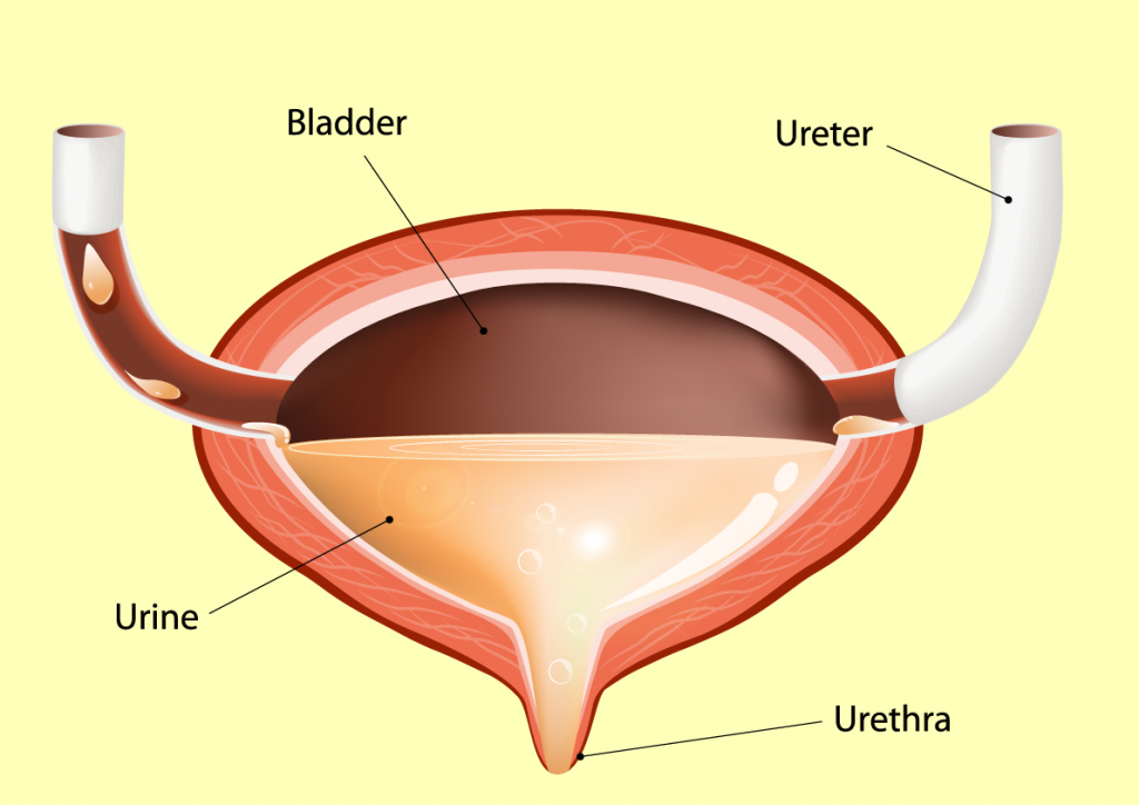 6 perguntas respondidas sobre a uretrocistoscopia